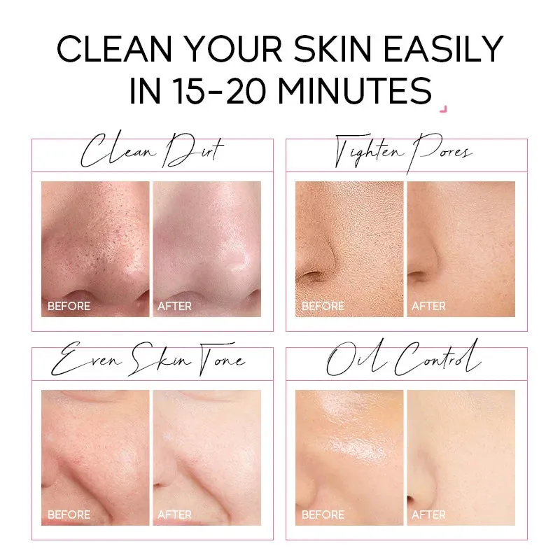 24K Gold Peeling Face Mask For Anti Aging And Brightening